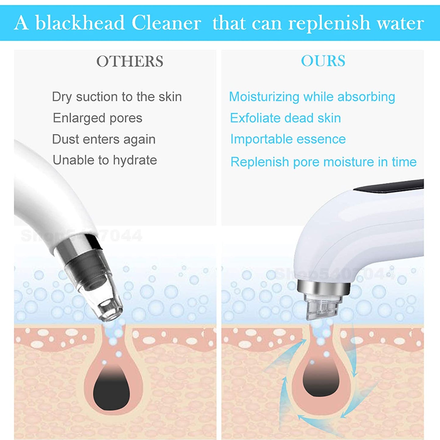 The Hydrafacial Dermabrasion Blackhead Vacuum Cleaner