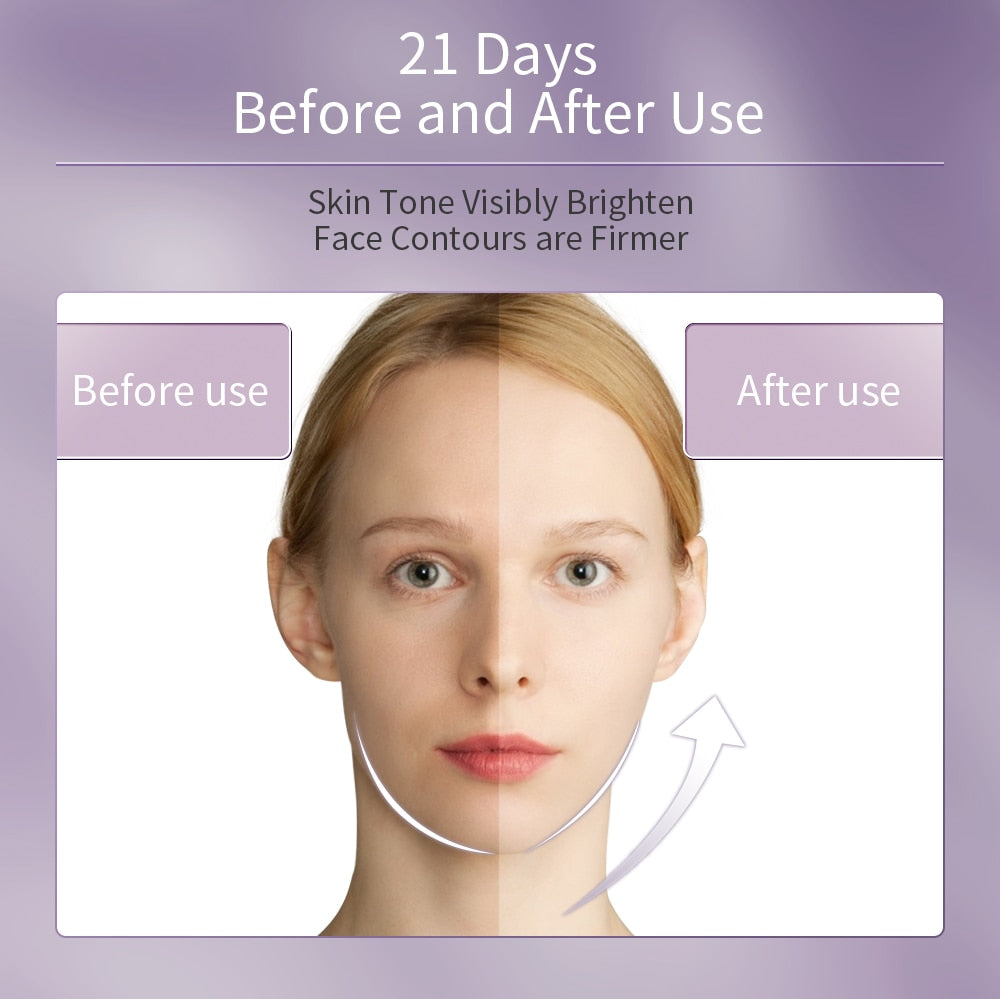 RF Lifting Facial Mesotherapy Skin Tightening Rejuvenation